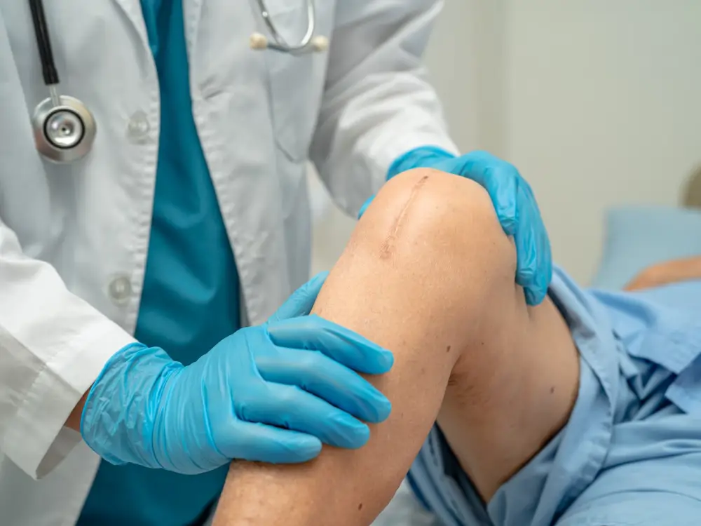 Avusturya Hastanelerinde Ameliyat İçin 7 Aya Varan Bekleme Süreleri!