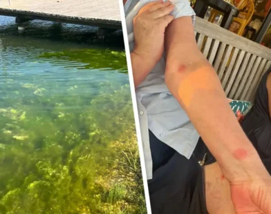 Burger Gölü’nde Deri Döküntüsü ve Yoğun Alg Tabakası Şikayetleri Artıyor