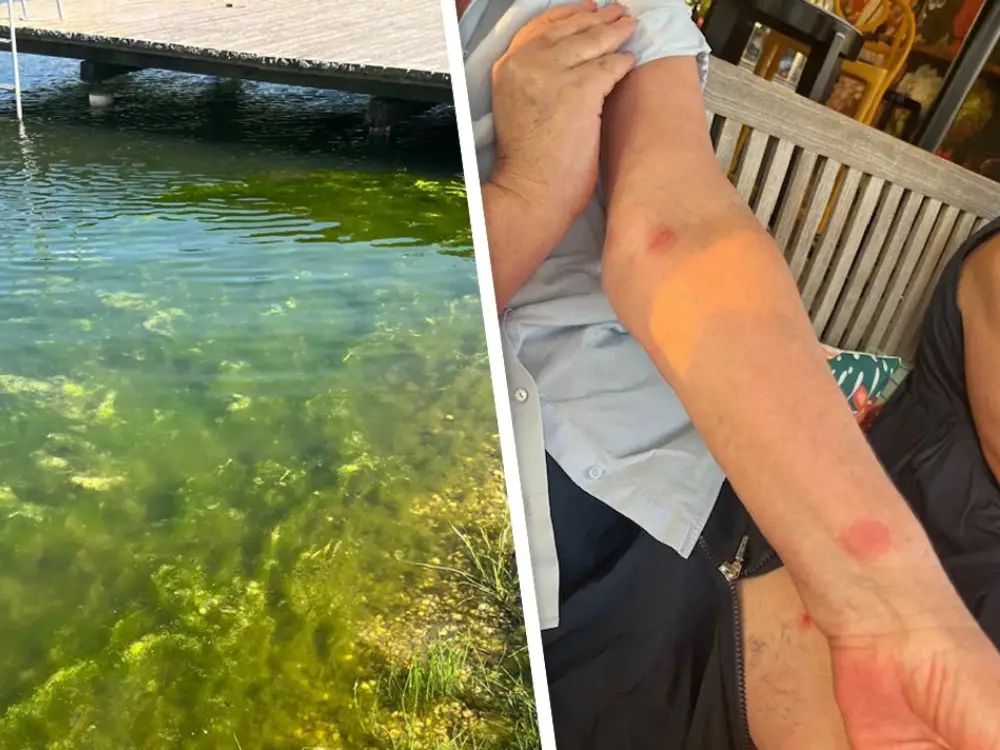 Burger Gölü’nde Deri Döküntüsü ve Yoğun Alg Tabakası Şikayetleri Artıyor