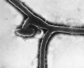 Çekya’da Ebola Şüphesi: ABD’li Yolcunun Durumu Ülke Genelinde Alarm Verdi