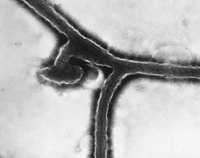 Çekya’da Ebola Şüphesi: ABD’li Yolcunun Durumu Ülke Genelinde Alarm Verdi