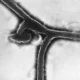 Çekya’da Ebola Şüphesi: ABD’li Yolcunun Durumu Ülke Genelinde Alarm Verdi Çekya’da Ebola Şüphesi: ABD’li Yolcunun Durumu Ülke Genelinde Alarm Verdi