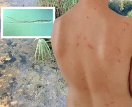 Göl Kenarında Tehlike: Entenflöhe (Ördek Piresi) Vakası Çocukları Vuruyor