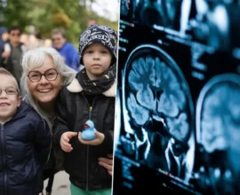 MPS I Hastalığı: Erken Tanı Hayat Kurtarıyor, Avusturya Geri Kalıyor